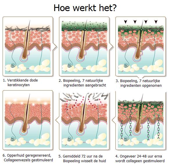 De werking van Biopeeling